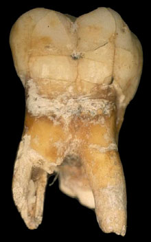 Molar trobat a la cova de Mollet. 215.000 aC. És la resta humana més antiga descoberta a Catalunya